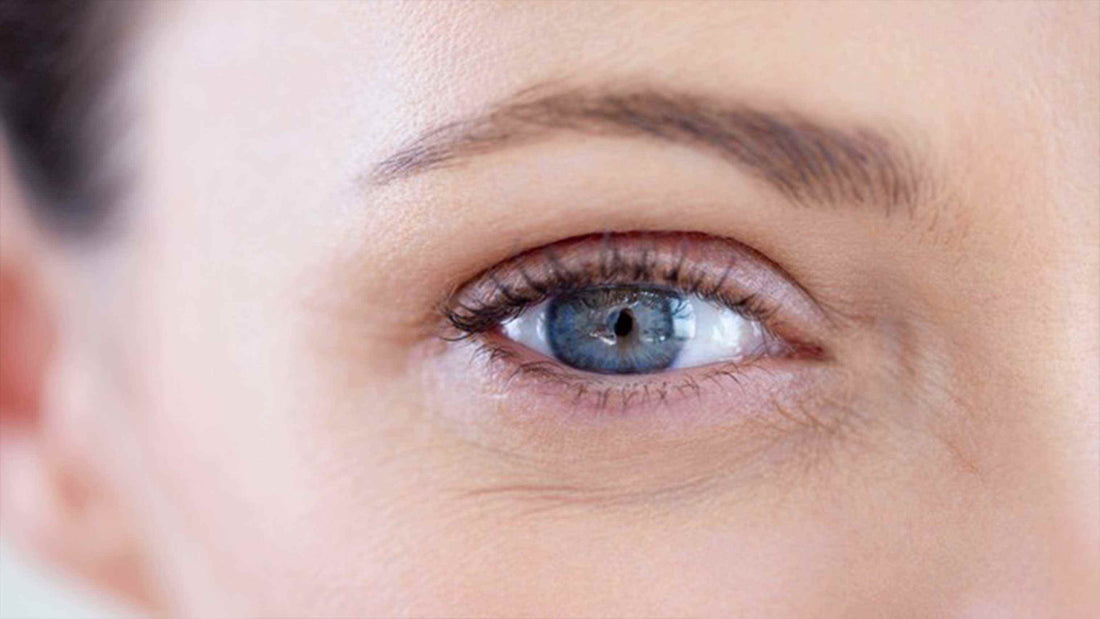 fine lines under female's eye