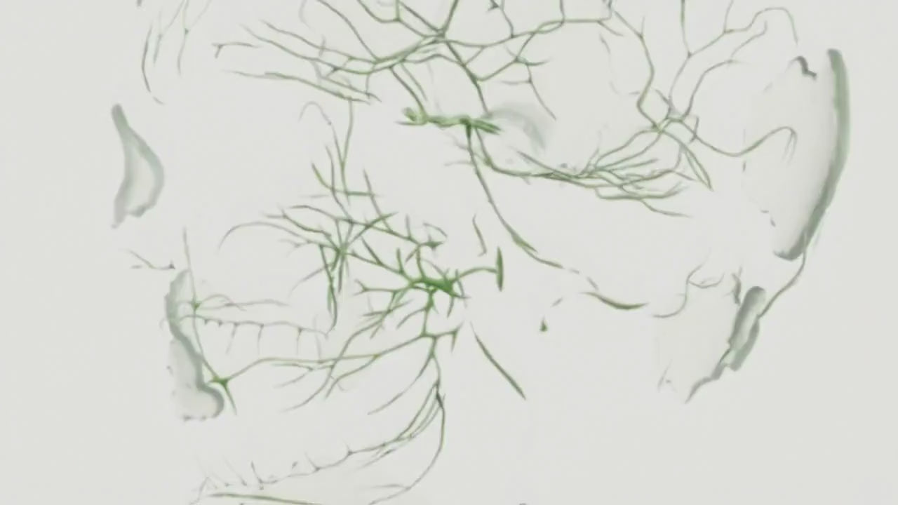 Load video: Anatomical illustration of a human body with green nervous system highlighted