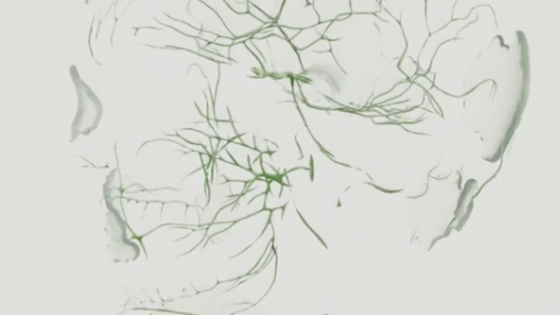 Load video: Anatomical illustration of a human body with green nervous system highlighted